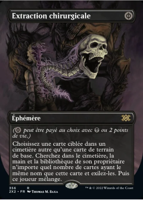 Extraction chirurgicale