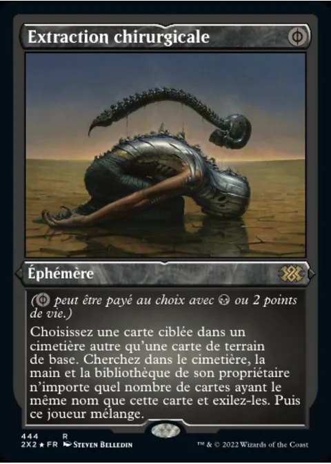 Extraction chirurgicale